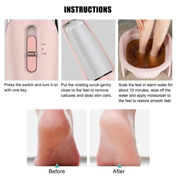 Callous Remover Electric Foot Pedicure Foot File Grinder Tools